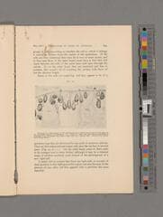 Go to image 123.